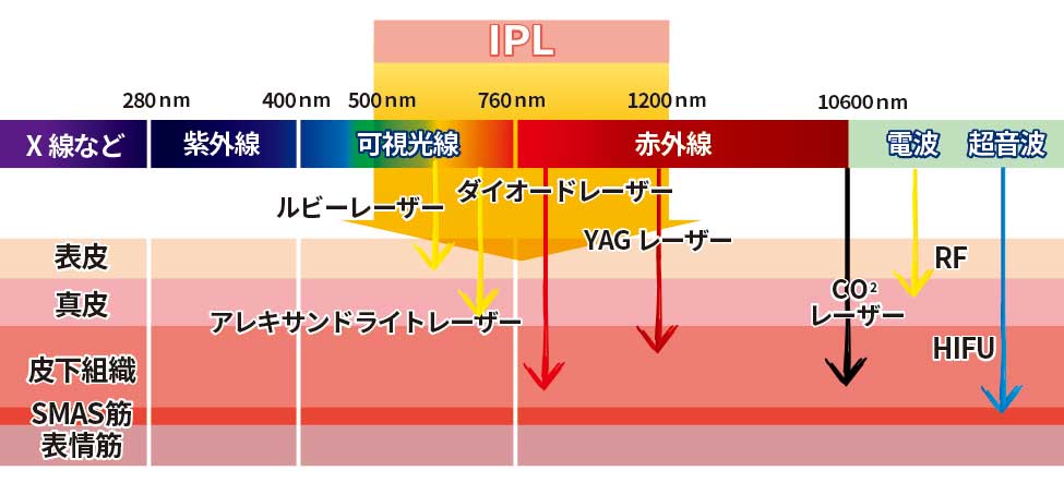 主なレーザーの種類とその他の治療機器